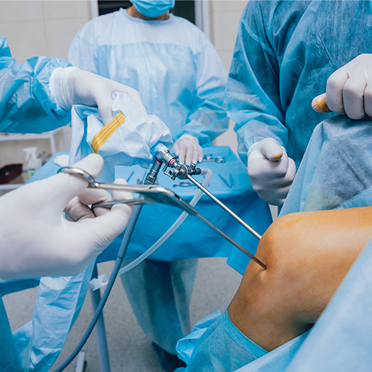arthroscope-surgery